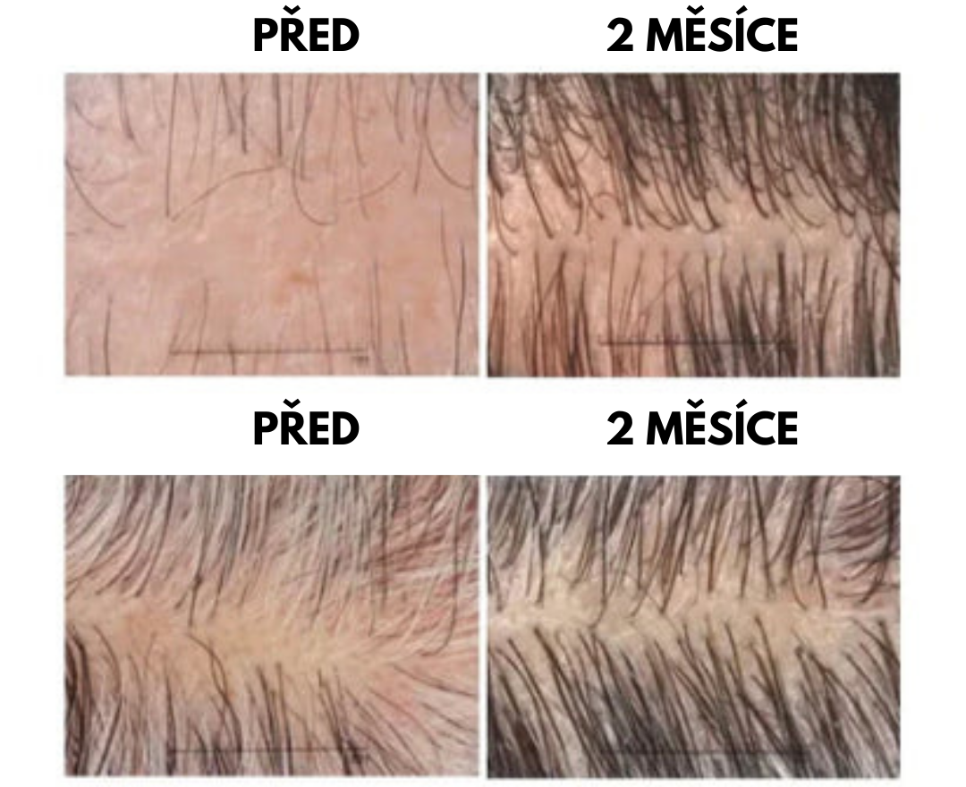 Blusoms - Peelingový Prostředek Pro Vlasy S Bohatým Obsahem žIvin Pro Obnovu Vlasových Kořínků